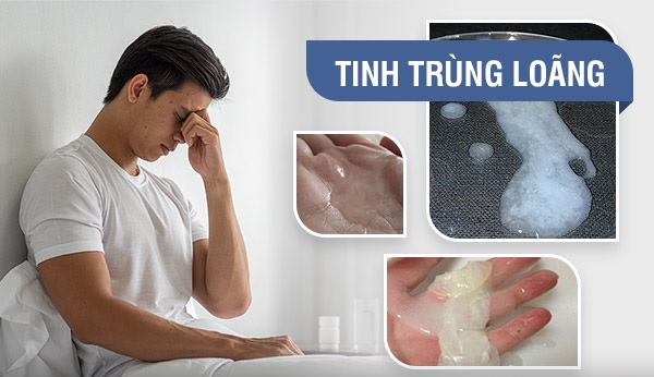 Tinh trùng loãng - nỗi lo vô sinh ở đàn ông? 2 image 1