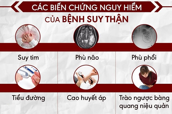 Nhận Biết Các Triệu Chứng Suy Thận Nhưng Nam Giới Thường Bỏ Qua 4 image 3