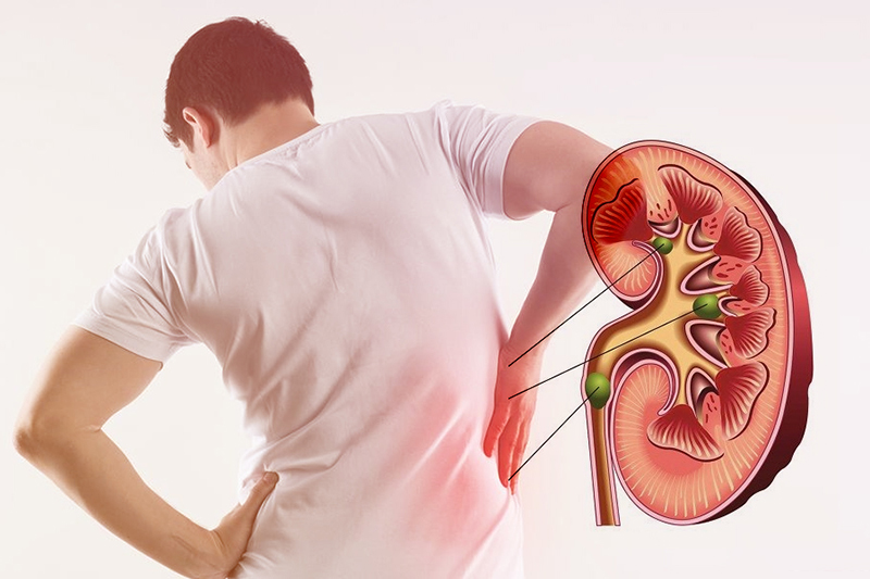 Nhận Biết Các Triệu Chứng Suy Thận Nhưng Nam Giới Thường Bỏ Qua 6 image 5