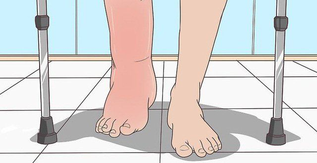Nhận Biết Các Triệu Chứng Suy Thận Nhưng Nam Giới Thường Bỏ Qua 7 image 6