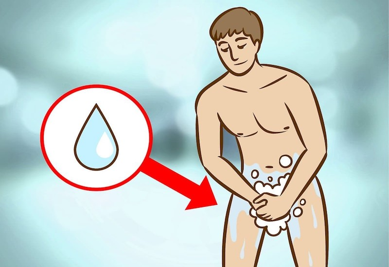 Viêm Nhiễm Nam Khoa: Nguyên Nhân, Triệu Chứng, Cách Điều Trị Dứt Điểm 4 image 1