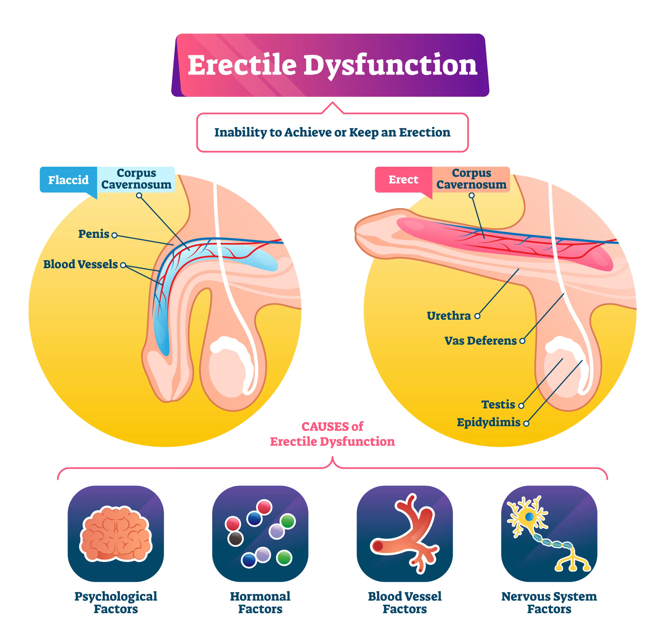 Is Erectile Dysfunction Only a Problem for Older Men? The Truth May Surprise Younger Men 2 image 99 scaled