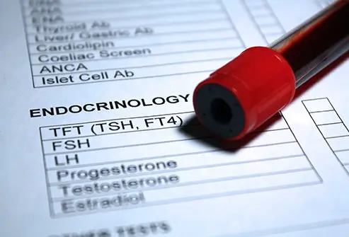 What are LH and FSH? Their role in male spermatogenesis 6 fsh test
