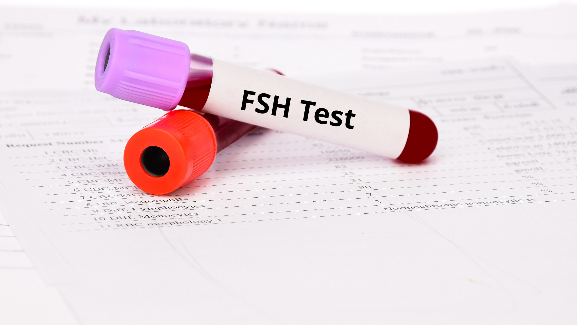 What are LH and FSH? Their role in male spermatogenesis 6 image 3