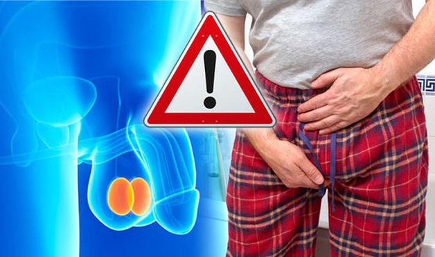 Brief or Sharp Testicular Pain When Standing: A Warning Sign Men Should Not Ignore 6 image 39