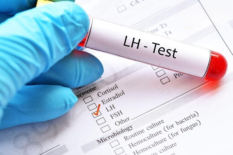 What are LH and FSH? Their role in male spermatogenesis 7 image